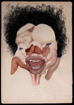 Ectopic pregnancy.jpg