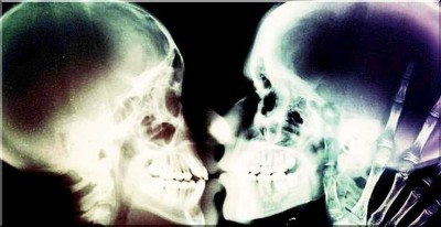 xraykiss.jpg